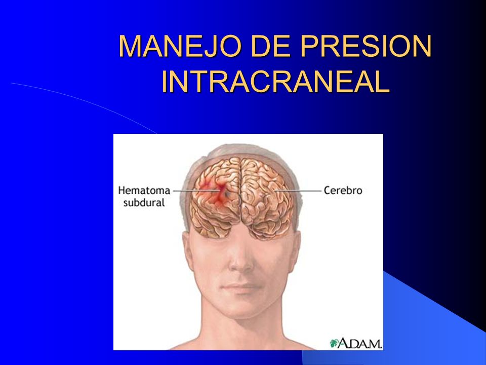 tipos de hipertension intracraneal tipos de hipertension intracraneal